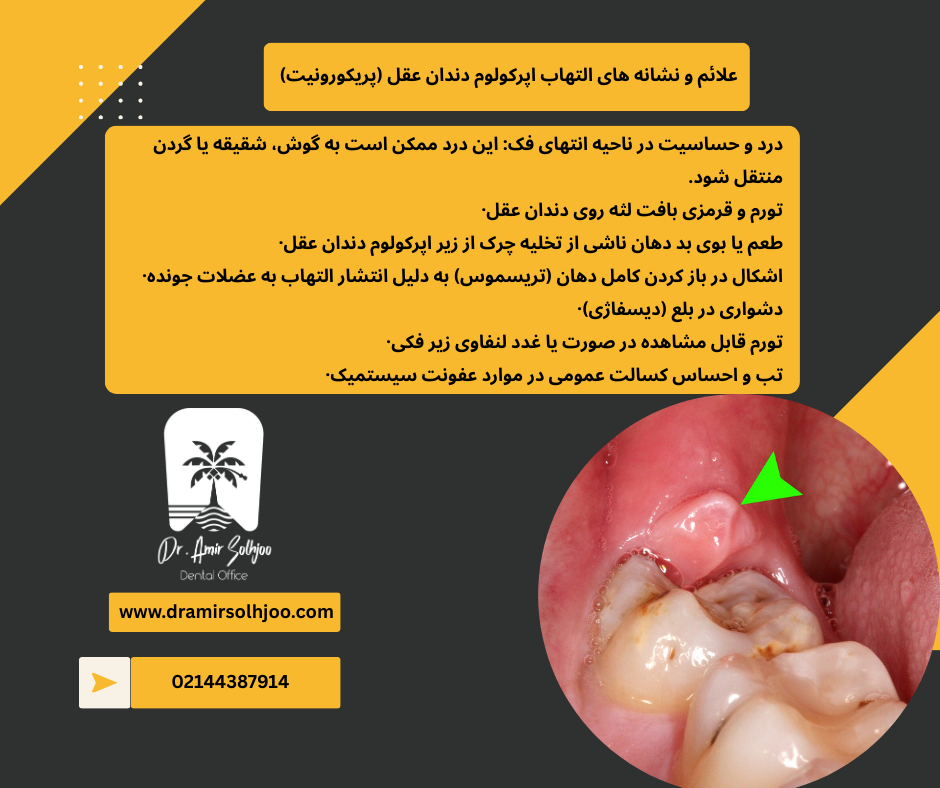 Wisdom tooth operculum