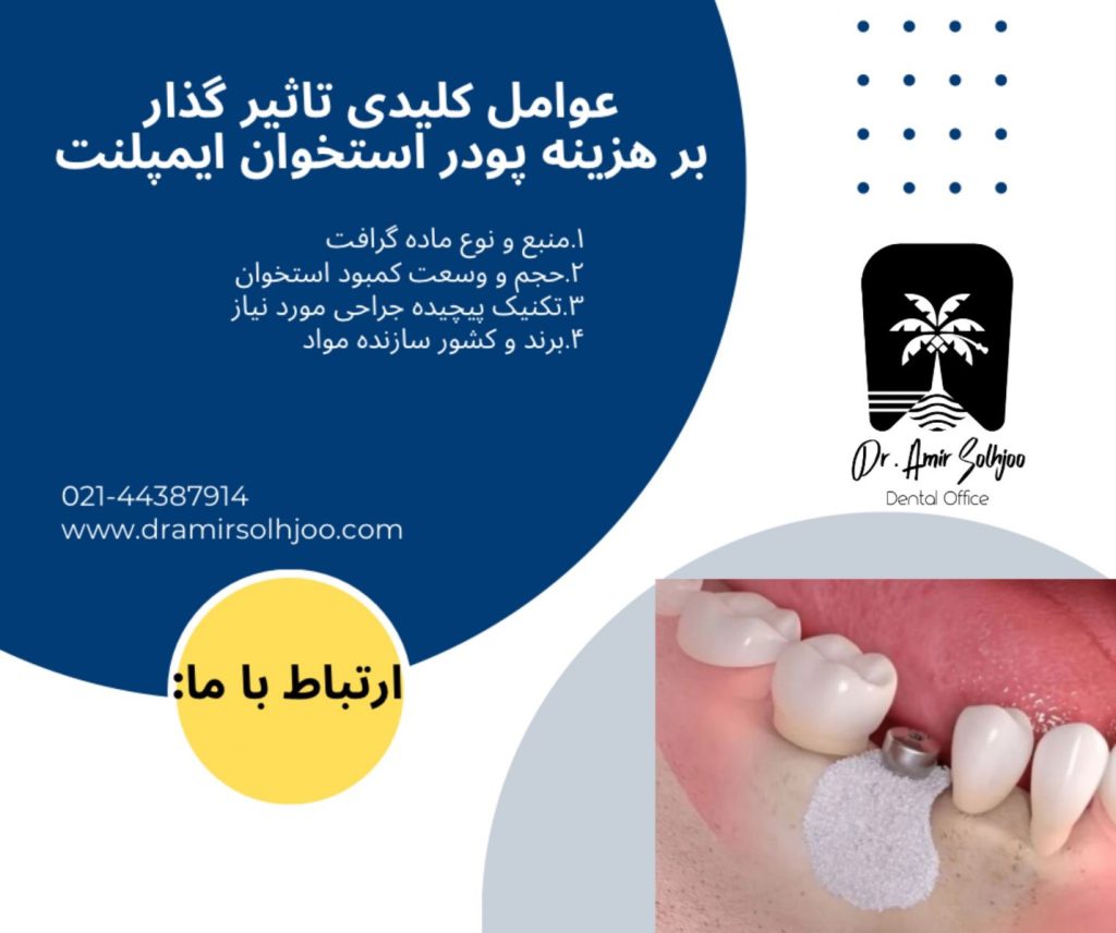 هزینه پودر استخوان ایمپلنت