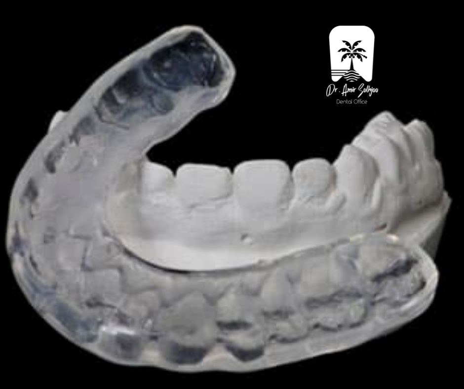 implant Teeth in people with grinding teeth