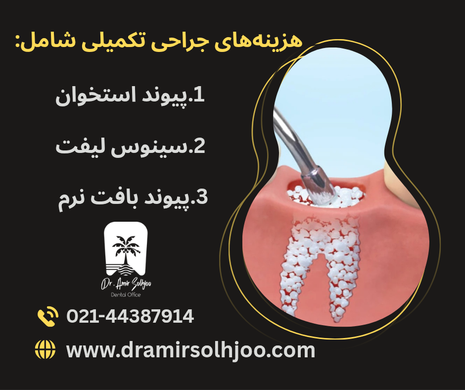 قیمت ایمپلنت کل دندان ها