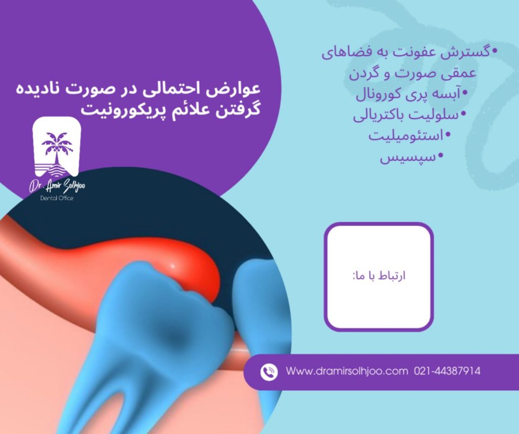 علائم پری کورونیت