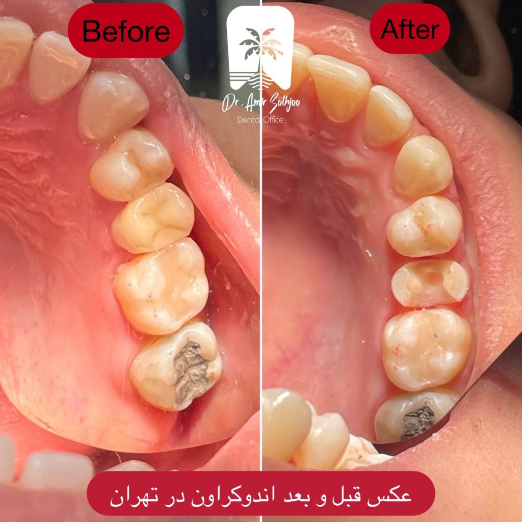 بهترین دندانپزشکی و دندانپزشک در شهرک غرب