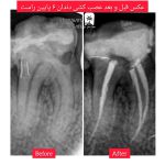دکتر خوب برای عصب کشی