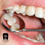 چکاپ دوره‌ای دندانپزشکی