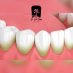 روش‌های علمی کنترل پلاک