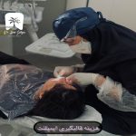 هزینه قالب گیری ایمپلنت