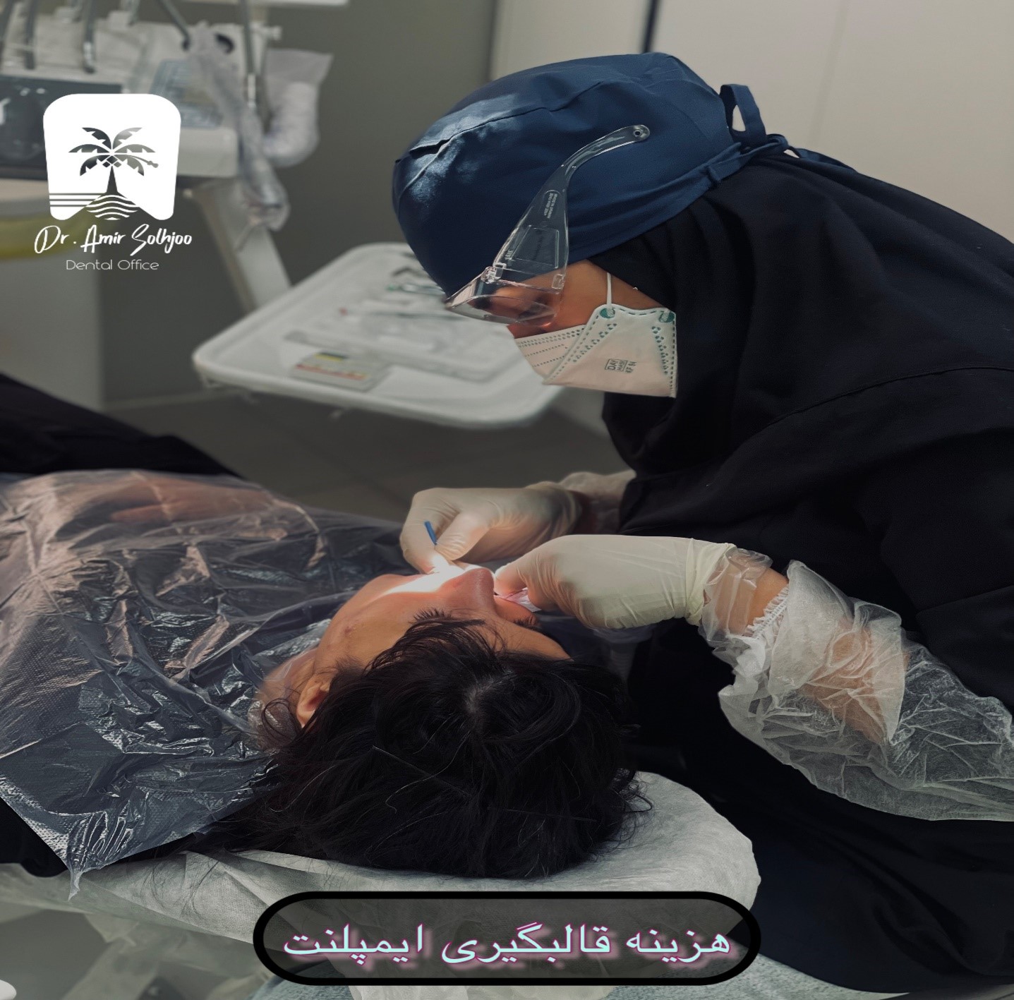 هزینه قالب گیری ایمپلنت