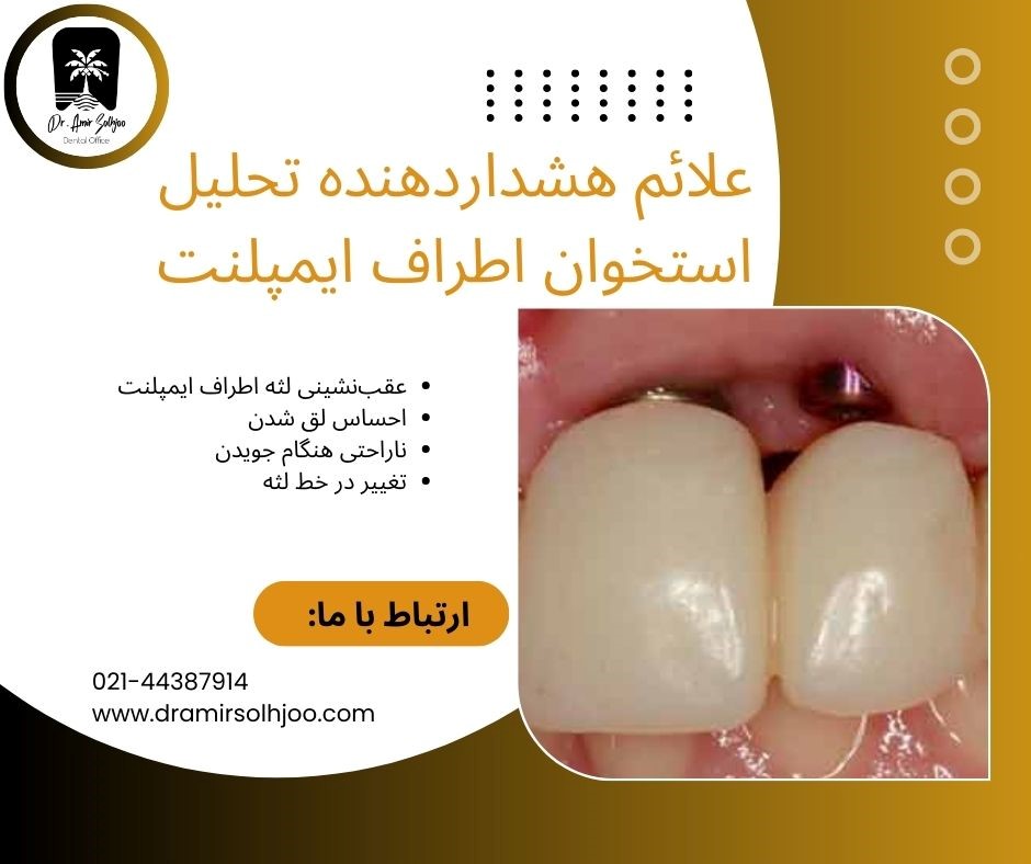 تحلیل استخوان اطراف ایمپلنت
