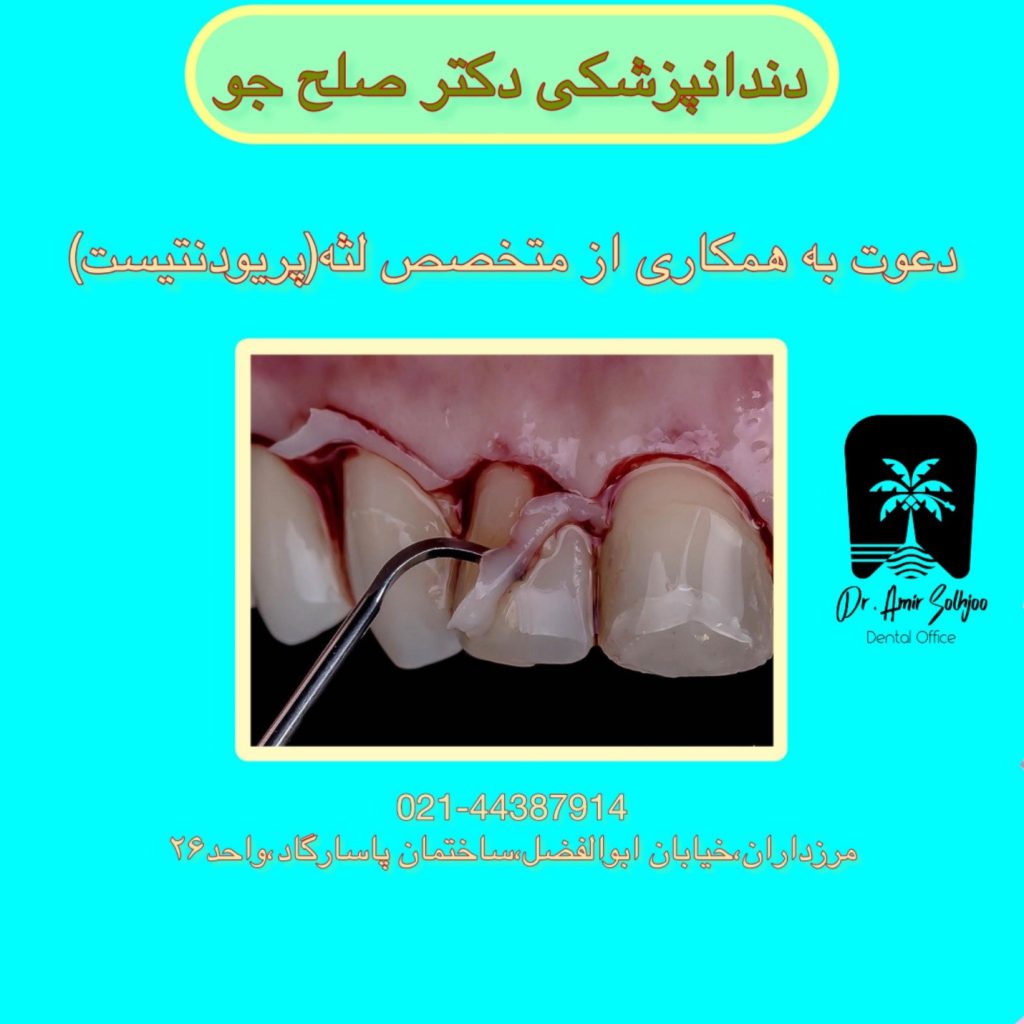استخدام متخصص جراحی لثه