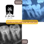 بهترین دکتر عصب‌کشی در نیاوران