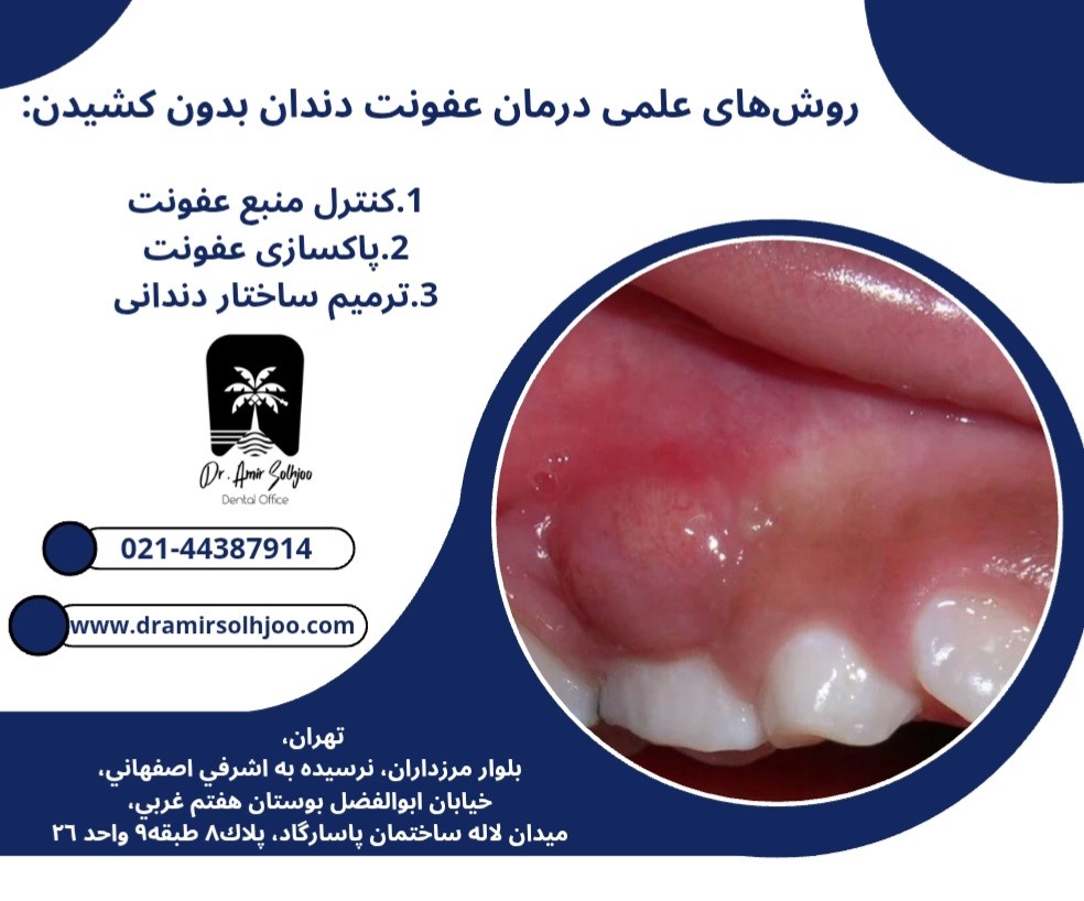 درمان عفونت دندان بدون کشیدن
