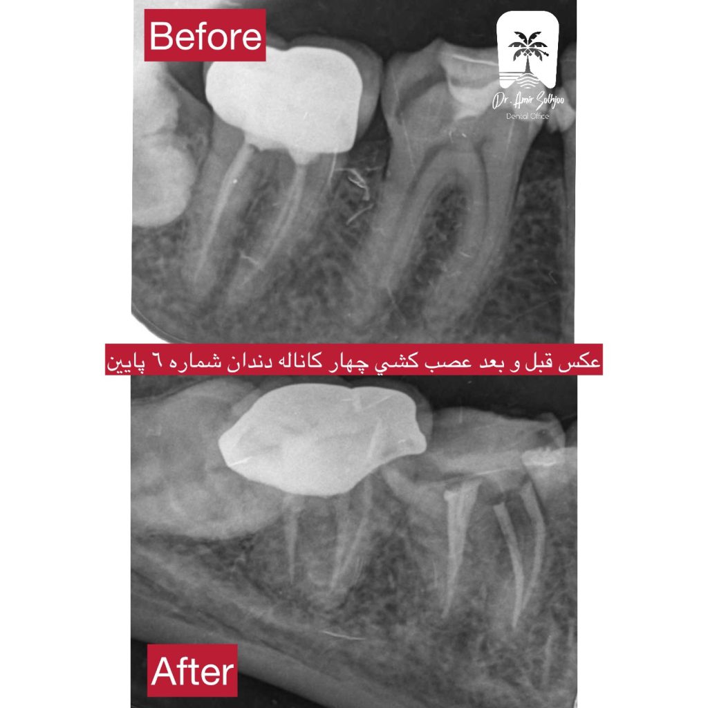 دعوت به همکاری از متخصص درمان ریشه