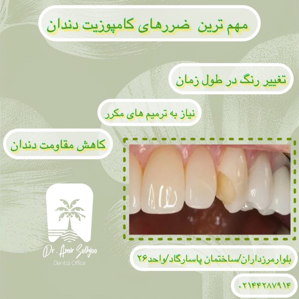 ضرر های کامپوزیت دندان