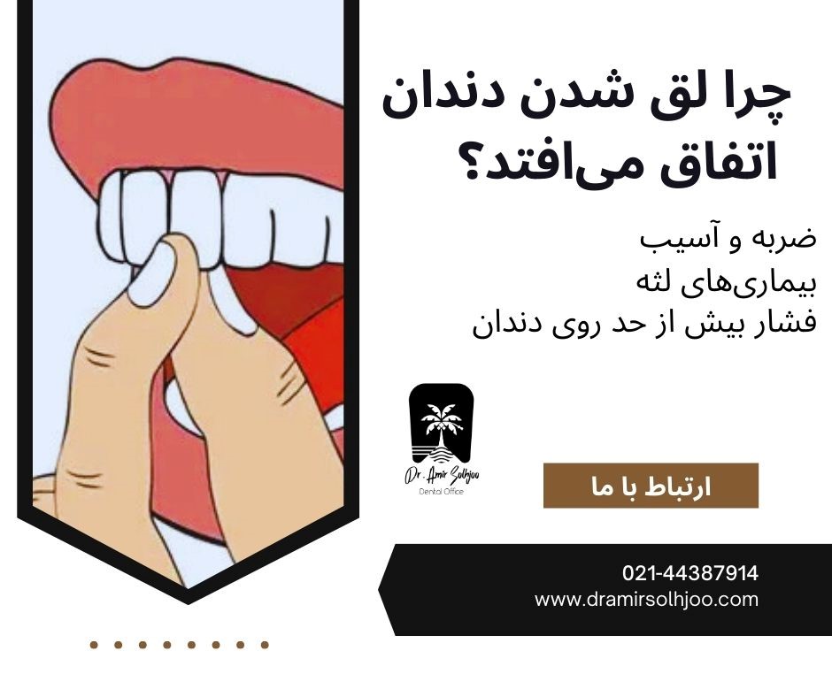 لق شدن دندان