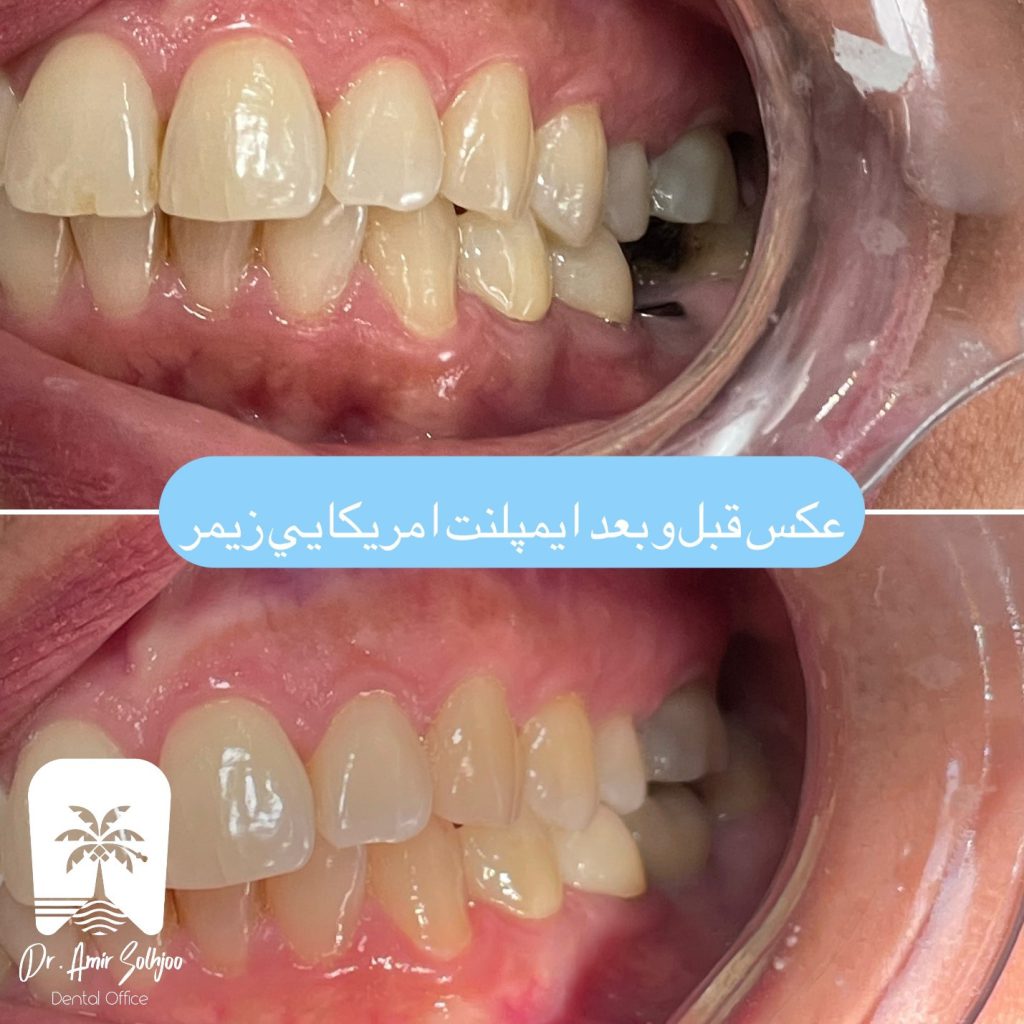دندانپزشک خوب در یوسف آباد تهران