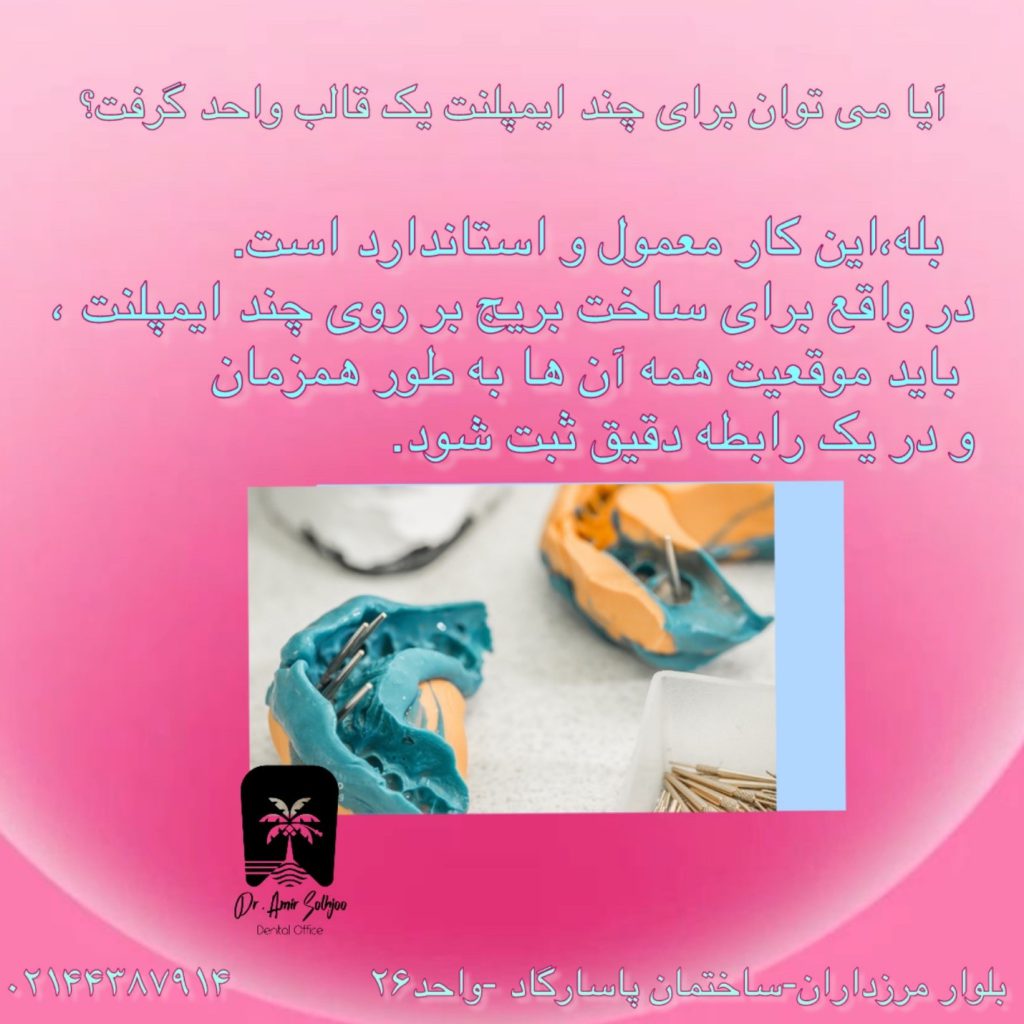 هزینه قالب گیری ایمپلنت