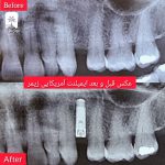 کلینیک دندانپزشکی در یوسف آباد تهران