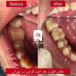 بهترین دندانپزشک در سهروردی تهران
