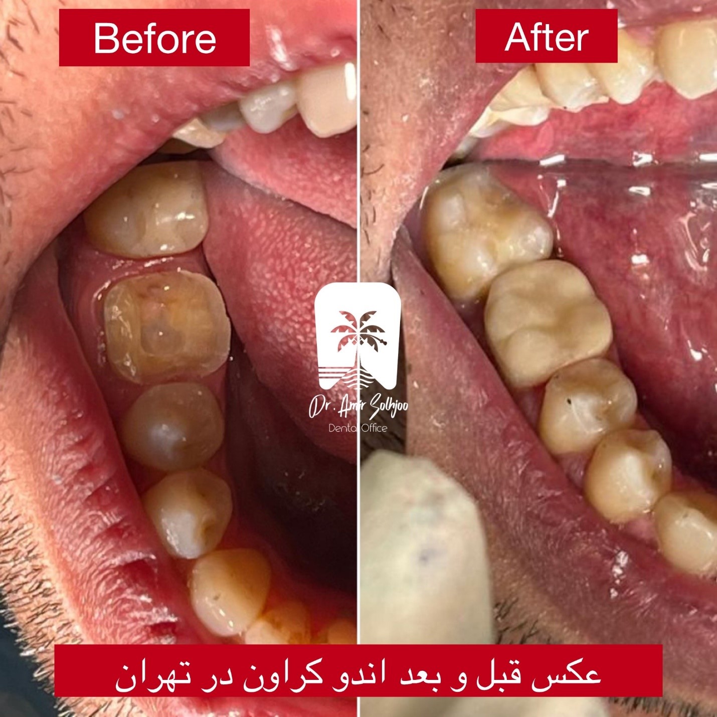 بهترین دندانپزشک در سهروردی تهران