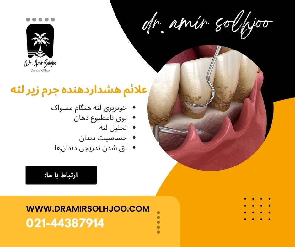 جرم زیر لثه