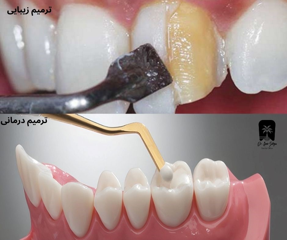 تفاوت ترمیم زیبایی و درمانی دندان