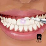 استخدام متخصص جراحی لثه