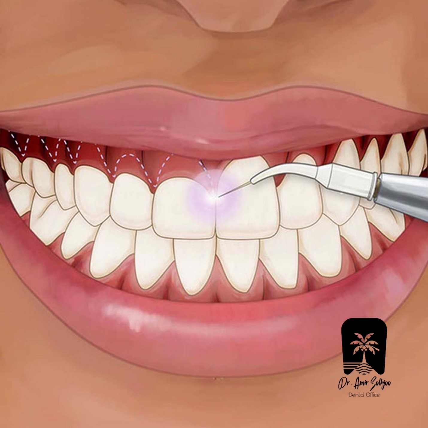 استخدام متخصص جراحی لثه