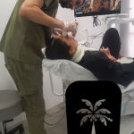 بهترین فوق تخصص ایمپلنت