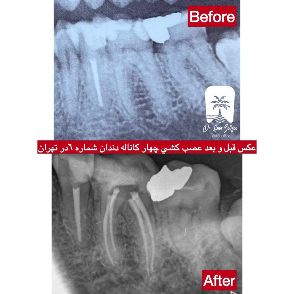 دعوت به همکاری از متخصص درمان ریشه