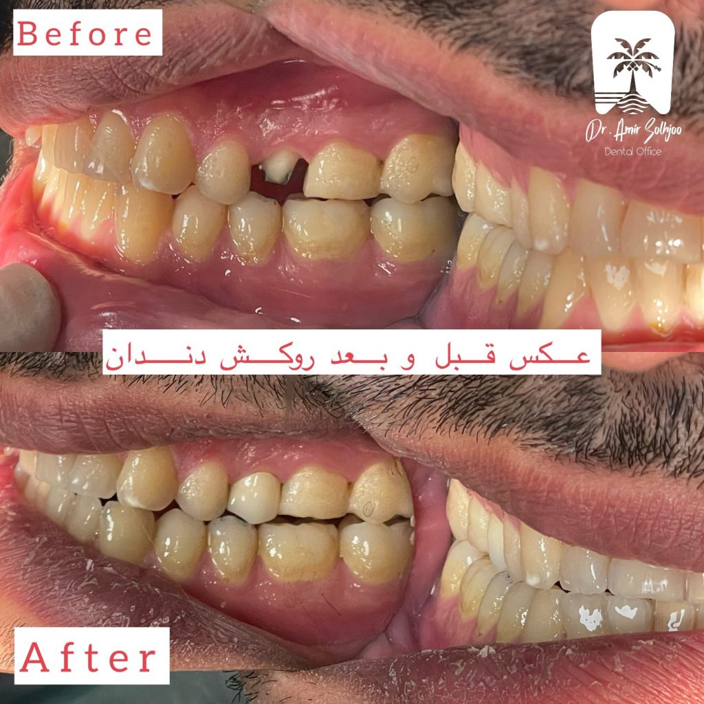 دندانپزشک خوب در یوسف آباد تهران