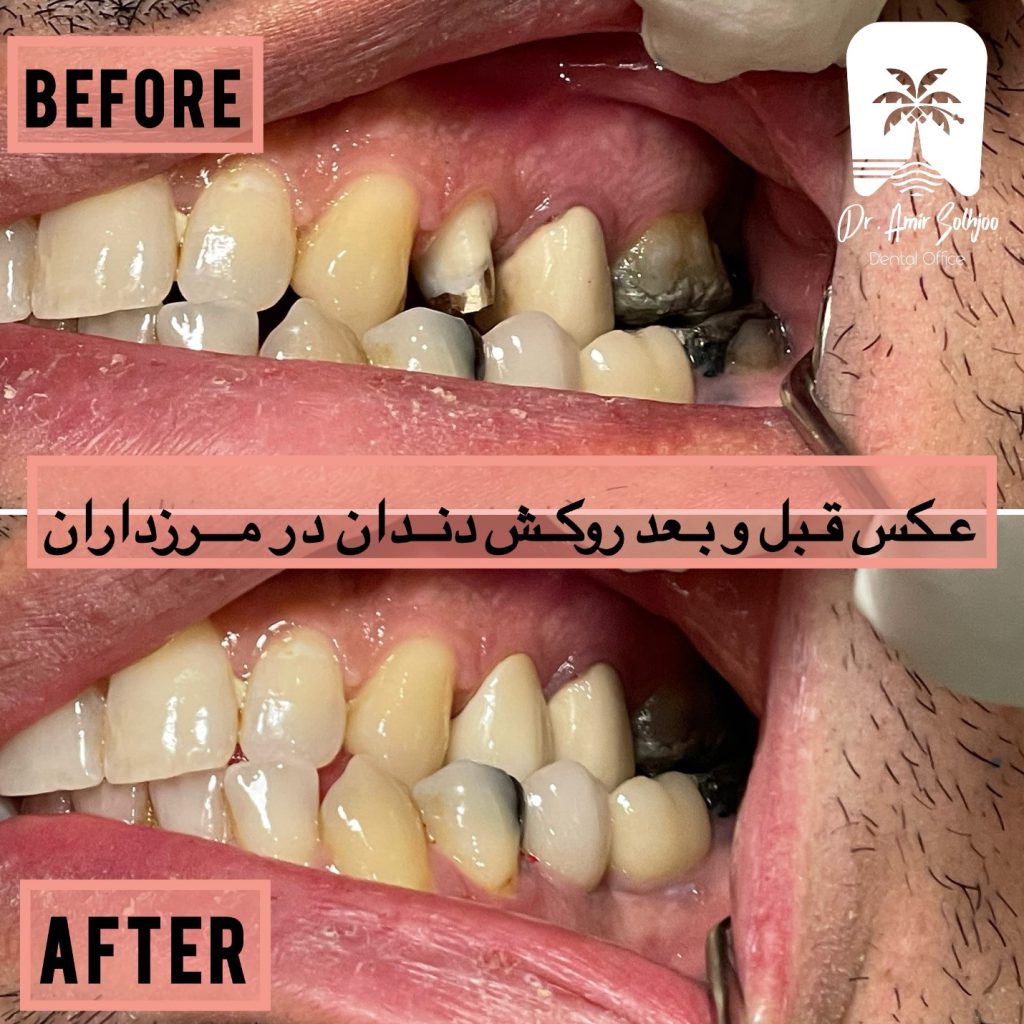 دندانپزشک خوب در یوسف آباد تهران