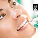 فاصله مناسب بین جرم گیری‌ها