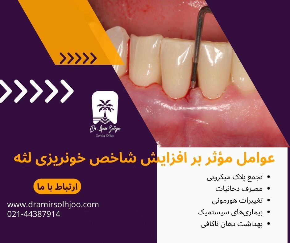 شاخص خونریزی لثه (BOP)