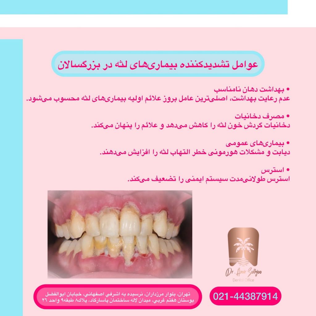 علائم اولیه بیماری‌های لثه