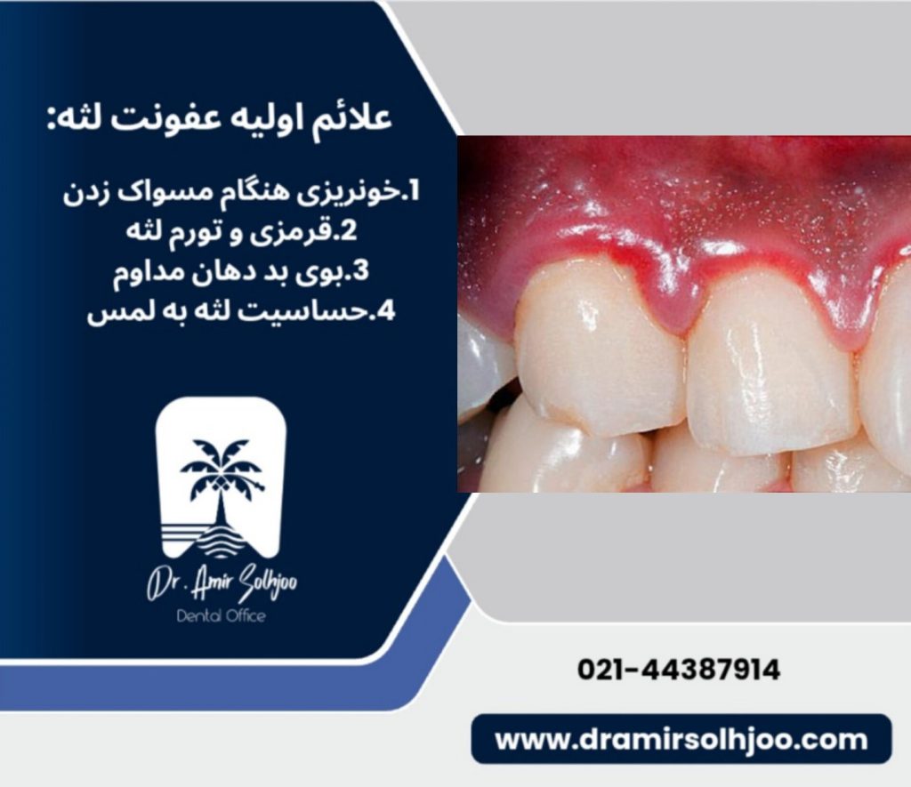 مراحل کنترل عفونت لثه