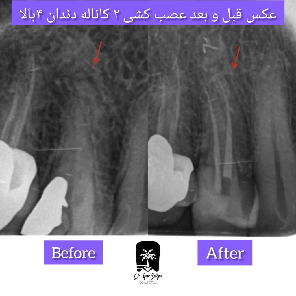 دندانپزشکی فعال در تعطیلات عید نوروز ۱۴۰۵