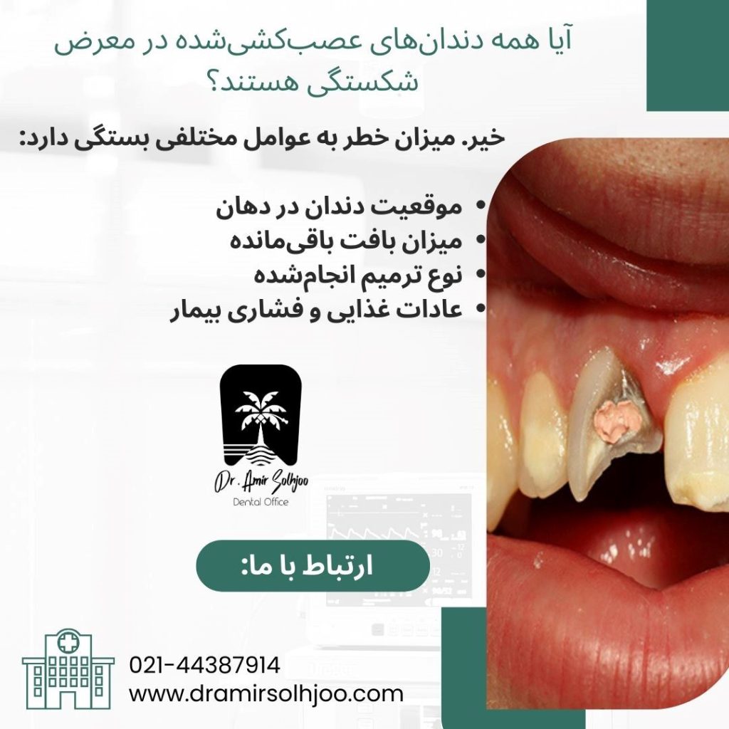 چرا دندان عصب کشی شده میشکند