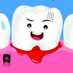 خونریزی لثه بعد از جرم گیری