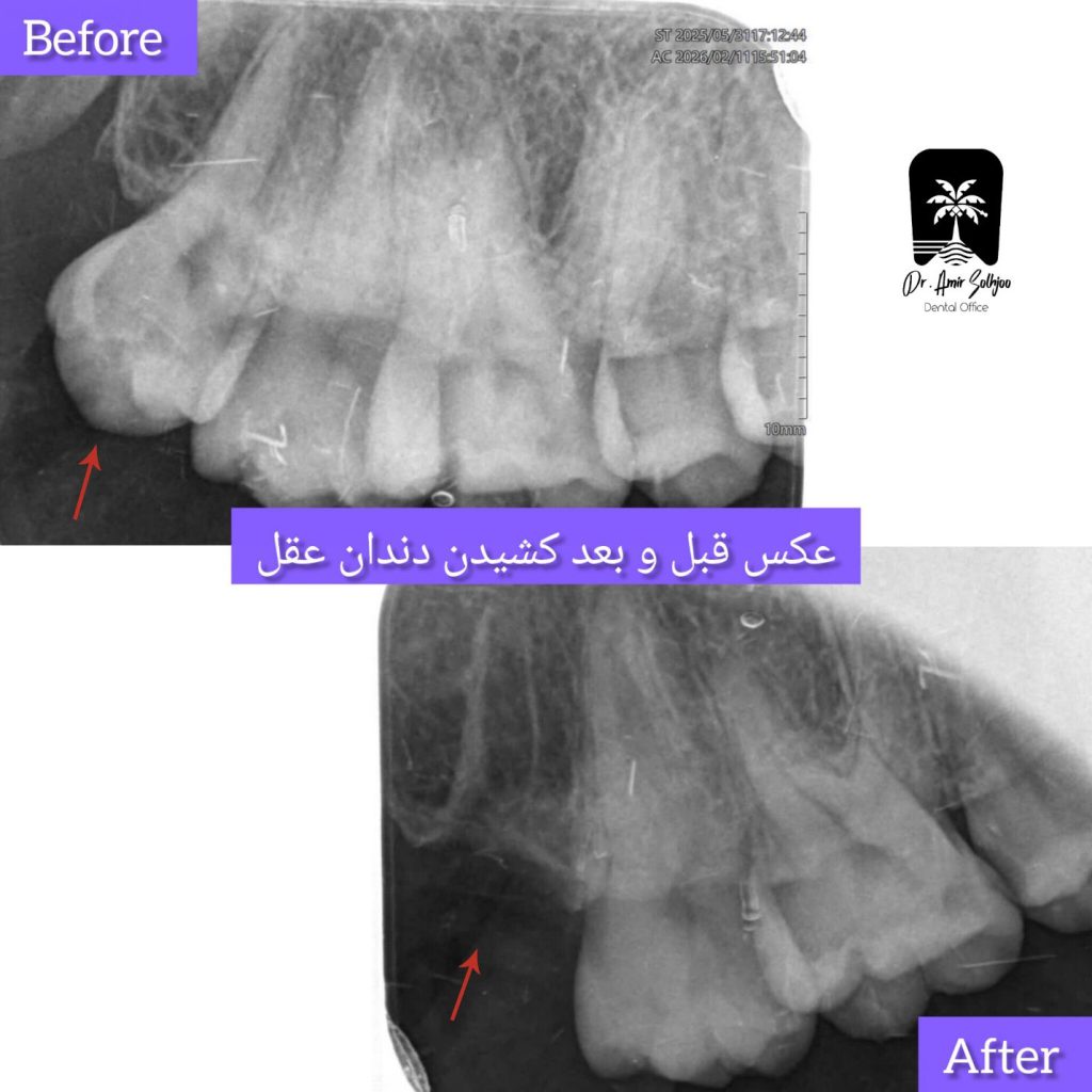 دندانپزشکی شبانه روزی در تهران