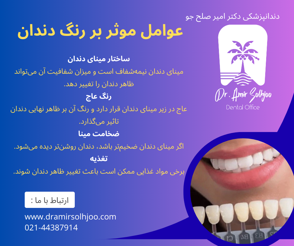 رنگ دندان