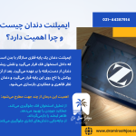 هزینه ایمپلنت دندان
