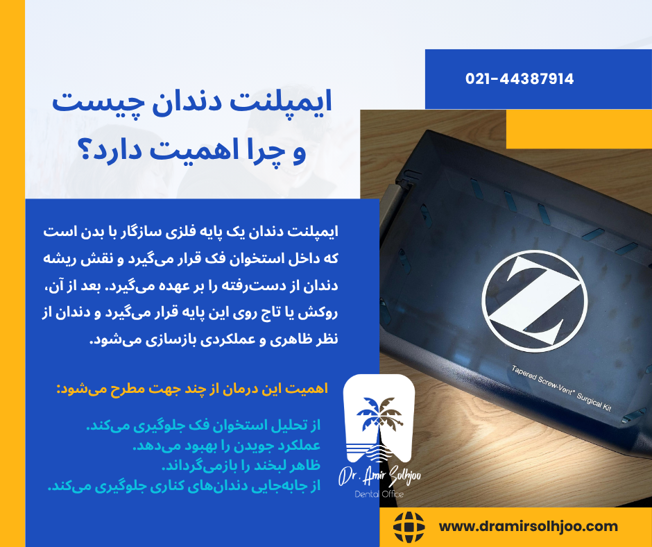 هزینه ایمپلنت دندان
