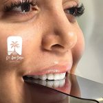 بهترین دکتر لمینت دندان در مرزداران تهران