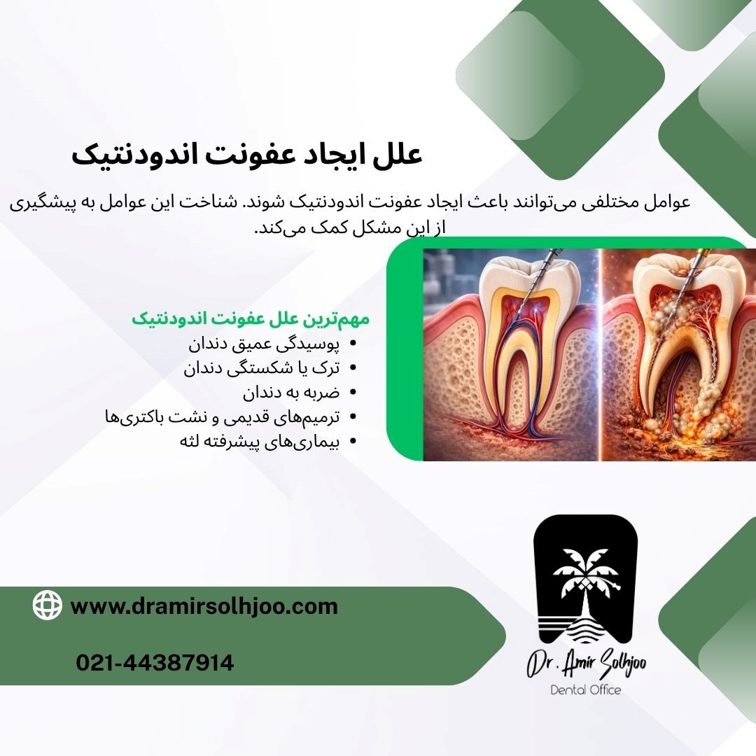 عفونت اندودنتیک