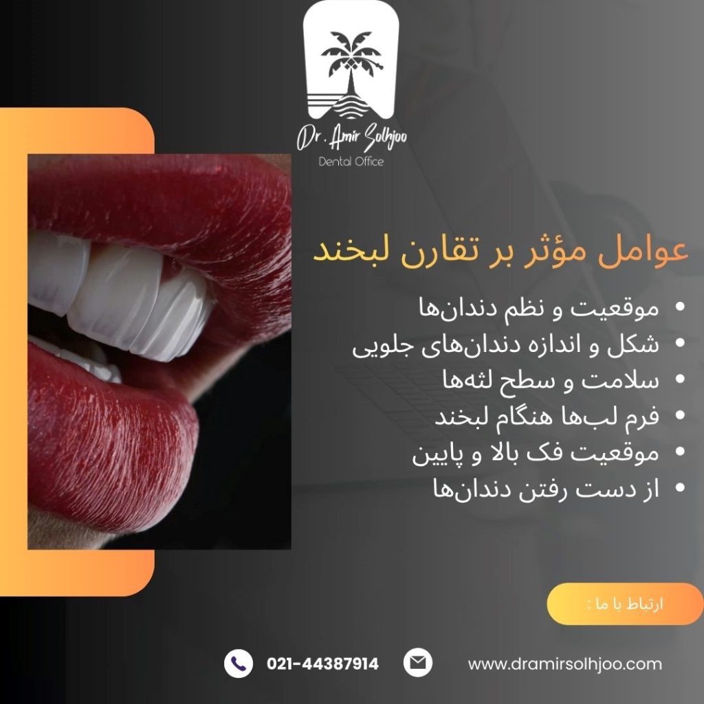 تقارن لبخند