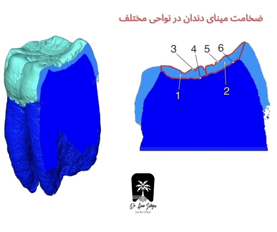 رنگ دندان