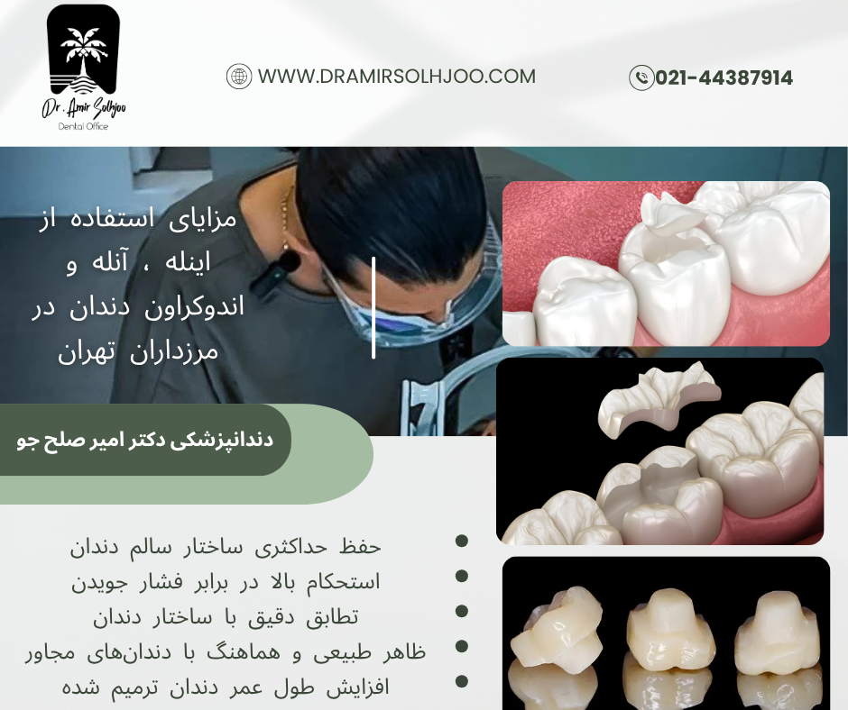 اینله ، آنله و اندوکراون دندان در مرزداران تهران