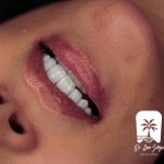 تقارن لبخند