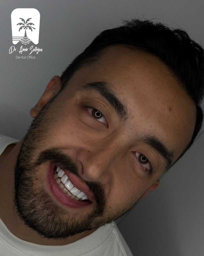 تقارن لبخند
