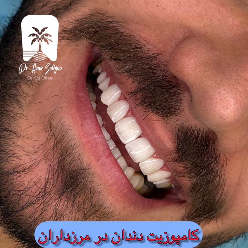 نمونه طرح لبخند